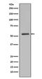 SMAD Family Member 5 antibody, M01423, Boster Biological Technology, Western Blot image 