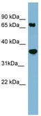 Protein Phosphatase 2 Scaffold Subunit Abeta antibody, TA344604, Origene, Western Blot image 
