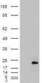 Cysteine And Glycine Rich Protein 2 antibody, GTX88912, GeneTex, Western Blot image 