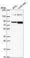 EPH Receptor B2 antibody, NBP2-56605, Novus Biologicals, Western Blot image 