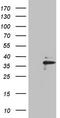 Endogenous Bornavirus Like Nucleoprotein 2 antibody, LS-C794595, Lifespan Biosciences, Western Blot image 