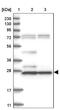 Histamine N-Methyltransferase antibody, NBP1-89495, Novus Biologicals, Western Blot image 