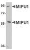 Zinc finger protein 667 antibody, PA5-20769, Invitrogen Antibodies, Western Blot image 