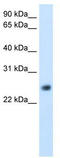Gamma-Glutamyltransferase Light Chain 1 antibody, TA346142, Origene, Western Blot image 