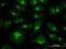 VDP p115 antibody, H00008615-M03, Novus Biologicals, Immunofluorescence image 