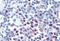C-C chemokine receptor type 4 antibody, MBS243898, MyBioSource, Immunohistochemistry paraffin image 