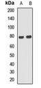 Ankyrin Repeat And Sterile Alpha Motif Domain Containing 1B antibody, orb412660, Biorbyt, Western Blot image 