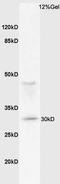 Leucine Rich Repeat Containing 25 antibody, orb157822, Biorbyt, Western Blot image 