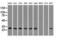 Replication Protein A2 antibody, M02067, Boster Biological Technology, Western Blot image 
