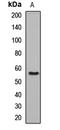 Regulator of G-protein signaling 7 antibody, LS-C667998, Lifespan Biosciences, Western Blot image 