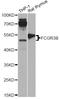 Fc-gamma RIIIb antibody, A13980, ABclonal Technology, Western Blot image 