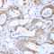 BCR Activator Of RhoGEF And GTPase antibody, LS-C358430, Lifespan Biosciences, Immunohistochemistry paraffin image 