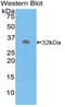 Phosphoenolpyruvate carboxylase antibody, LS-C295888, Lifespan Biosciences, Western Blot image 