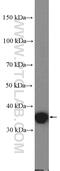Proline/serine-rich coiled-coil protein 1 antibody, 27130-1-AP, Proteintech Group, Western Blot image 