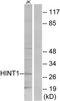 Histidine triad nucleotide-binding protein 1 antibody, TA312903, Origene, Western Blot image 