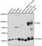 Dystroglycan 1 antibody, GTX64471, GeneTex, Western Blot image 