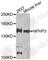 Nephrocystin 3 antibody, A8580, ABclonal Technology, Western Blot image 