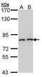 Seprase antibody, PA5-27773, Invitrogen Antibodies, Western Blot image 