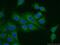 Death-inducer obliterator 1 antibody, 11790-1-AP, Proteintech Group, Immunofluorescence image 