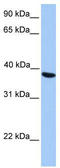 N(Alpha)-Acetyltransferase 80, NatH Catalytic Subunit antibody, TA346764, Origene, Western Blot image 