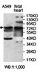 Kelch Repeat And BTB Domain Containing 2 antibody, orb78112, Biorbyt, Western Blot image 