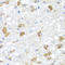 Phosphatidylinositol 4-Kinase Type 2 Beta antibody, A09390-1, Boster Biological Technology, Immunohistochemistry paraffin image 