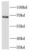 Fidgetin Like 1 antibody, FNab03129, FineTest, Western Blot image 