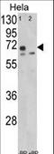 Leiomodin 1 antibody, LS-C165812, Lifespan Biosciences, Western Blot image 