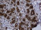SERPINE1 MRNA Binding Protein 1 antibody, LS-C175445, Lifespan Biosciences, Immunohistochemistry paraffin image 