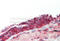 Cell surface glycoprotein MUC18 antibody, ARP63483_P050, Aviva Systems Biology, Immunohistochemistry frozen image 