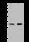 CutC Copper Transporter antibody, 203584-T44, Sino Biological, Western Blot image 