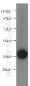 Sorbitol Dehydrogenase antibody, 15881-1-AP, Proteintech Group, Western Blot image 