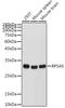 Ribosomal Protein S4 X-Linked antibody, GTX32850, GeneTex, Western Blot image 