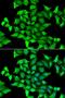 Sep (O-Phosphoserine) TRNA:Sec (Selenocysteine) TRNA Synthase antibody, orb247807, Biorbyt, Immunocytochemistry image 
