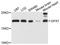Glutathione peroxidase 7 antibody, A3902, ABclonal Technology, Western Blot image 