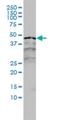 RAR-alpha antibody, H00005914-M01, Novus Biologicals, Western Blot image 
