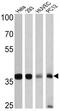 GAPDH antibody, GTX82899, GeneTex, Western Blot image 
