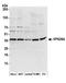 VPS26, Retromer Complex Component A antibody, A304-801A, Bethyl Labs, Western Blot image 