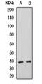 Arginine And Serine Rich Coiled-Coil 1 antibody, orb412565, Biorbyt, Western Blot image 