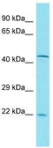 Ectonucleotide Pyrophosphatase/Phosphodiesterase 7 antibody, TA335355, Origene, Western Blot image 