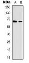 Eukaryotic translation initiation factor 3 subunit L antibody, MBS8222318, MyBioSource, Western Blot image 