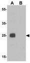 Homeobox protein EMX1 antibody, GTX17163, GeneTex, Western Blot image 