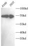 Melanoma-associated antigen D2 antibody, FNab10752, FineTest, Western Blot image 