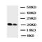 Histone Deacetylase 2 antibody, orb27564, Biorbyt, Western Blot image 
