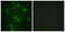RB Transcriptional Corepressor 1 antibody, LS-C199531, Lifespan Biosciences, Immunofluorescence image 