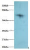 Ribosomal Protein S18 antibody, MBS715622, MyBioSource, Western Blot image 