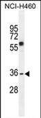 V-Set And Transmembrane Domain Containing 4 antibody, PA5-71486, Invitrogen Antibodies, Western Blot image 