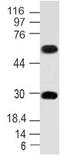 Mi antibody, M00269, Boster Biological Technology, Western Blot image 