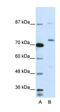 Exosome Component 10 antibody, orb324836, Biorbyt, Western Blot image 