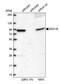 DEAD-Box Helicase 18 antibody, PA5-65284, Invitrogen Antibodies, Western Blot image 